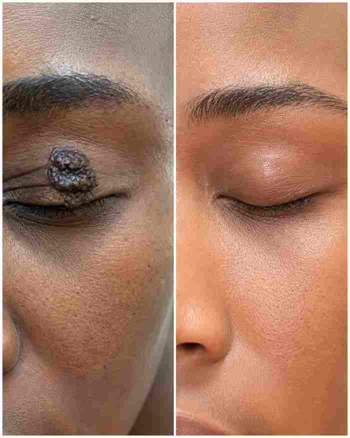 Birthmark & Dark Spot Care Treatment