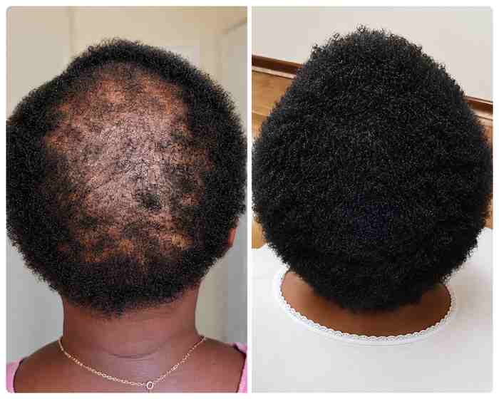 Hair Growth & Scalp Nourishing Treatment