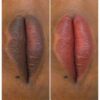 Skin Revision 2-Tone Lip Care Cream