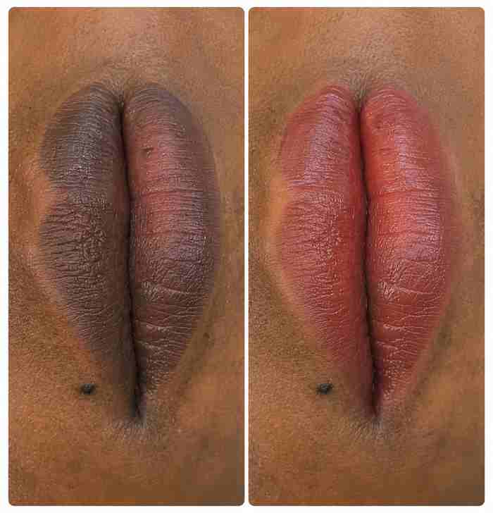 Skin Revision 2-Tone Lip Care Cream