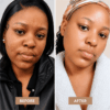 ZURIÉ Clear Skin Cream – Dark Mark & Even Tone Care