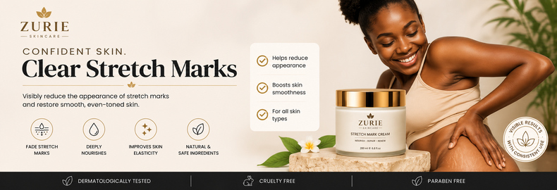 zurie_stretch_marks_banner_790x270_clear_150kb